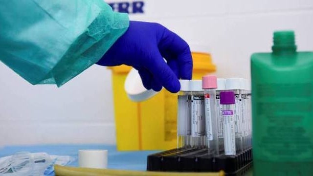 Covid-19: Laboratório da Unidade Local de Saúde da Guarda realizou nove mil testes