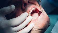 Imagem de Consultórios de medicina dentária vão permanecer de portas fechadas (Áudio)