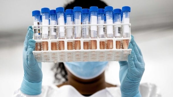 Imagem de 24 mil casos da variante do Reino Unido