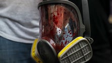 Imagem de Grupo de direitos humanos refere quatro mortos em protestos na Venezuela