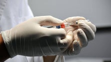 Imagem de Vírus da gripe modificado inibe desenvolvimento do cancro do pâncreas