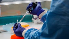 Imagem de Covid-19: Alemanha regista quase 160 mil pessoas curadas de entre 177 mil casos