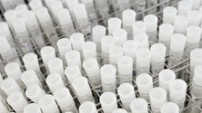 Imagem de Distinguido projeto sobre prognóstico de doentes com cancro gástrico