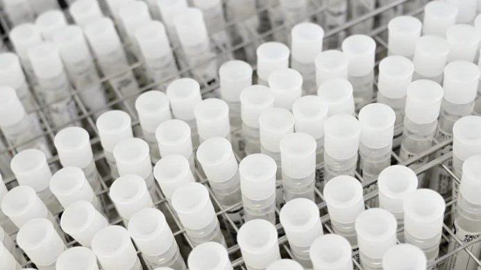 Imagem de Distinguido projeto sobre prognóstico de doentes com cancro gástrico