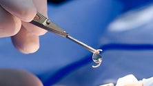 Imagem de Mais de dois mil madeirenses estão à espera de uma cirurgia às cataratas (áudio)