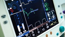Imagem de Grupo Bensaude oferece ventiladores aos hospitais da Região