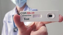 Imagem de Testes antes do embarque vão conter entrada de casos positivos (Vídeo)