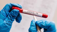 Imagem de Covid-19: Cerca de 76% dos infetados na Madeira já recuperaram da doença (Vídeo)