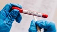 Imagem de Covid-19: Cerca de 76% dos infetados na Madeira já recuperaram da doença (Vídeo)
