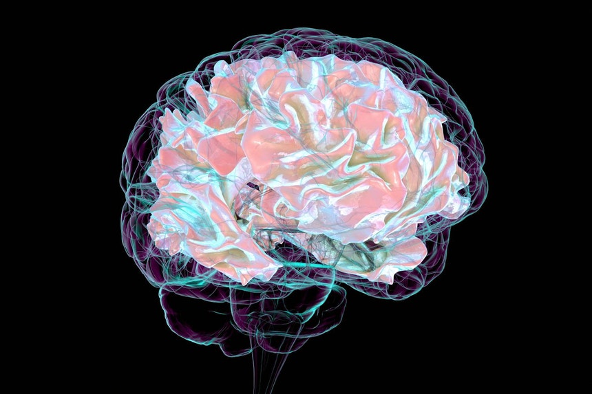 Imagem de Tratamento personalizado? Descobertos dois novos subtipos de esclerose múltipla