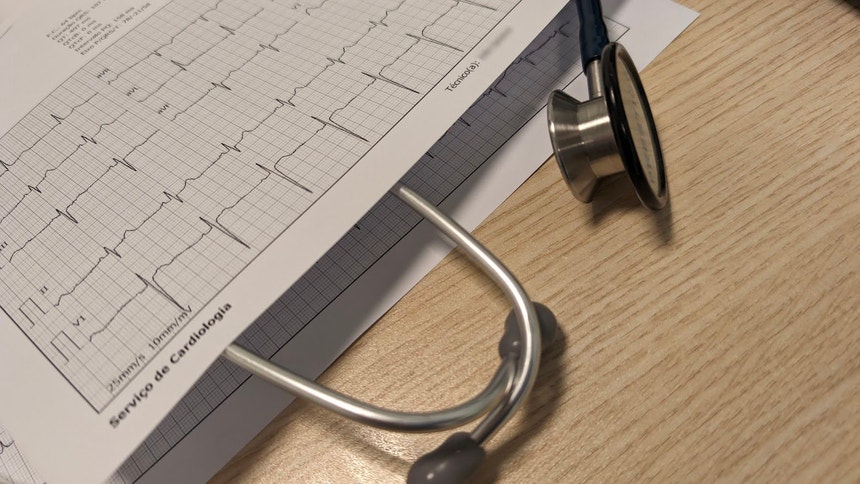 Imagem de Doentes cardíacos em lista de espera com pior prognóstico do que oncológicos