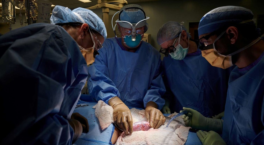 Equipa de cirurgiões examinam o rim à procura de sinais de rejeição. O orgão foi implantado fora do corpo para que o pudessem observar e retirar amostras de tecido durante as 54 horas de estudo permitidas
