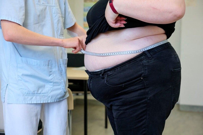 Estado vai comparticipar 15% dos medicamentos para a obesidade em doentes acompanhados