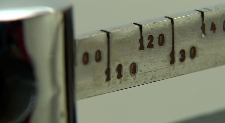 Imagem ilustrativa: Associação garante que há obesos a morrer por falta de acesso a tratamento