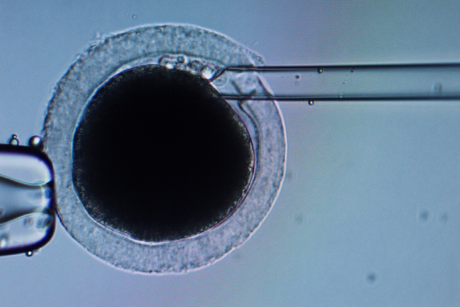  Imagem microsc&oacute;pica da insemina&ccedil;&atilde;o /Thomas Peter - Reuters 