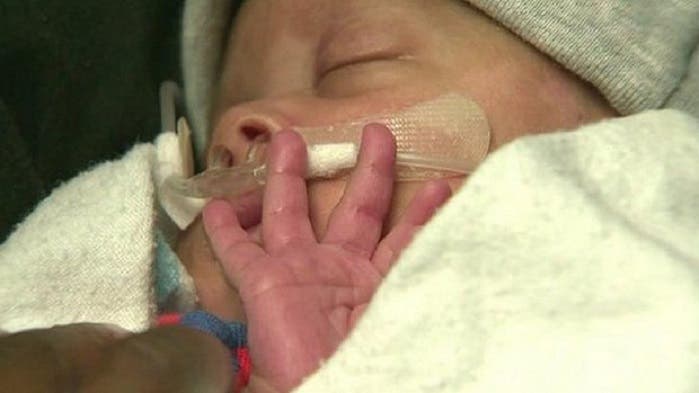 Silas Phillips com 10 semanas Foto: DR Silas Phillips com 10 semanas Foto: DR