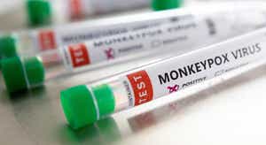 Monkeypox. Pessoas infetadas devem cumprir isolamento, pede Centro Europeu