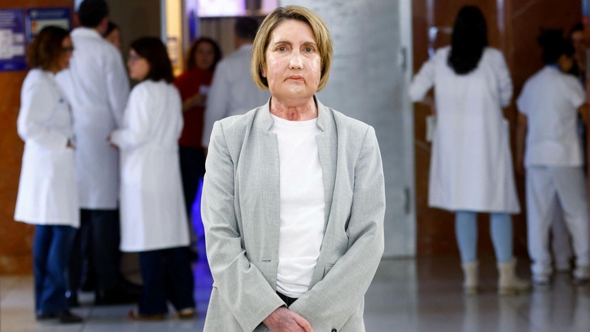 Imagem ilustrativa: Hospital de Barcelona faz primeiro transplante de rosto do mundo a partir de da