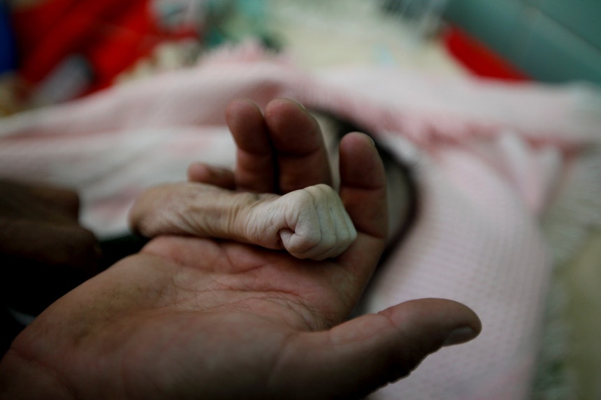 Pai segura a mão de bebé que morreu à fome, no Iémen
