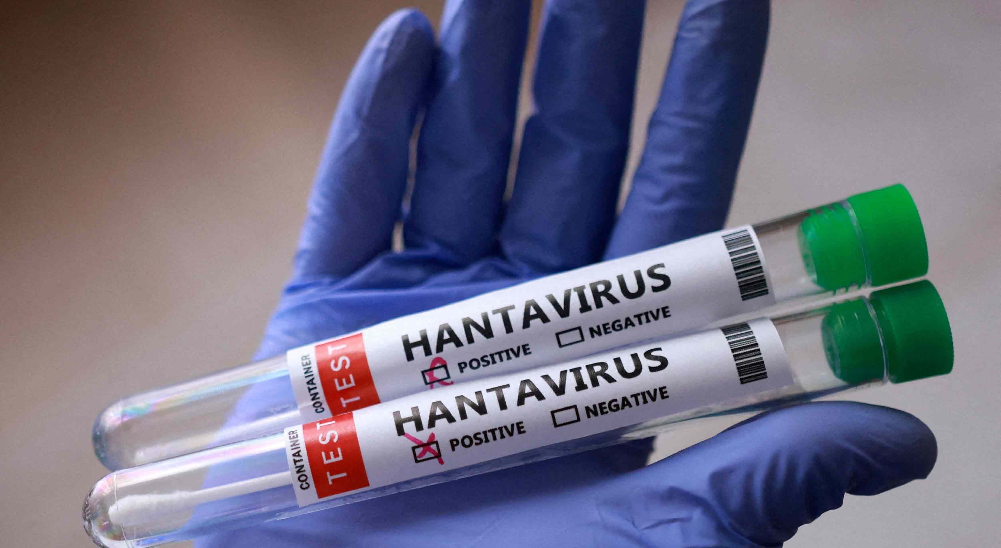 Hantavírus. Hospitalizados 22 franceses que tiveram contacto com passageira infetada