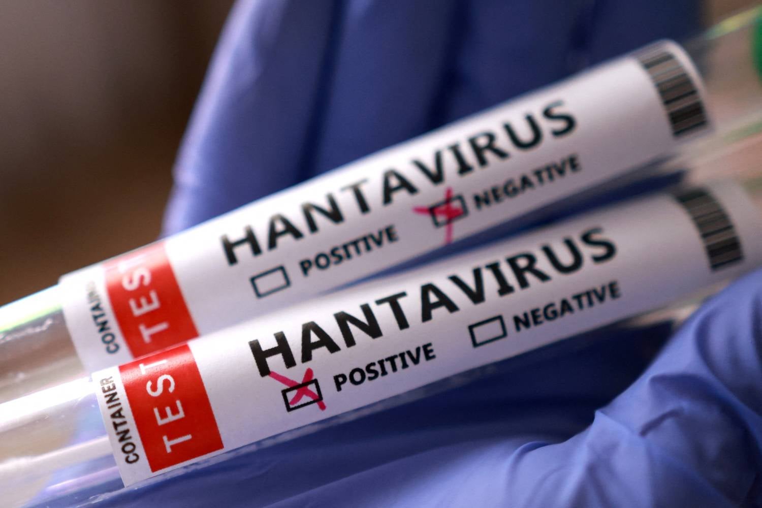 Reino Unido confirma terceiro caso suspeito de hantavírus