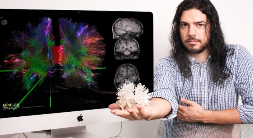Paulo Rodrigues - Engenheiro informático da Universidade do Minho que está a participar no projeto 3D do cérebro.
