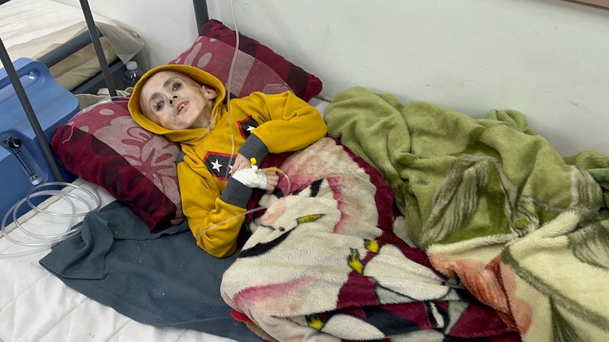Yazan Al-Kafarna, um rapaz com paralisia cerebral, morreu de fome face à inexistência no território de alimentação específica para o seu caso devido ao cerco montado pelos israelitas há cinco meses.
