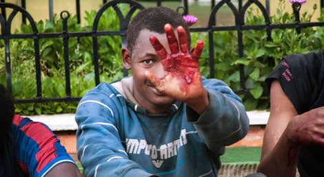 Um imigrante mostra as feridas provocadas pelo arame farpado das tr&ecirc;s barreiras de sete metros de altura que protegem o enclave espanhol de Melilla em Marrocos, que ele conseguiu ultrapassar dia 28 de fevereiro de 2014 (Reuters)