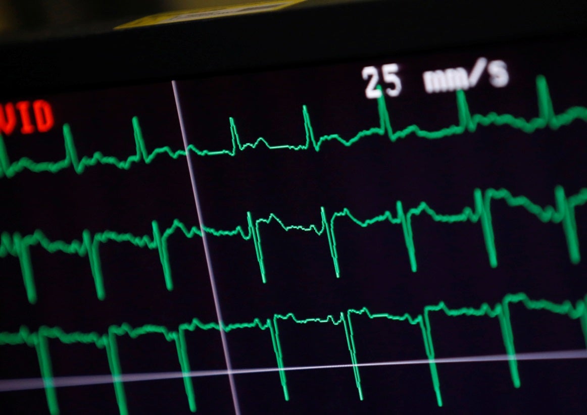 Nova tecnologia permite avalia��o card�aca de doentes em casa