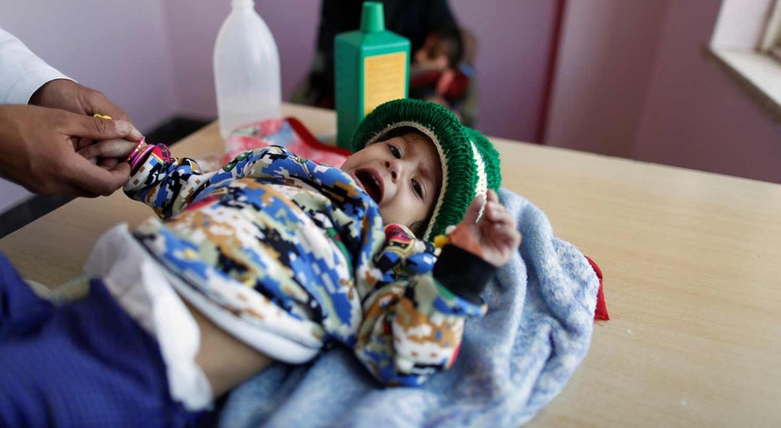 Uma criança tratada por má nutrição num hospital da Sanaa, a 4 de novembro de 2014.
