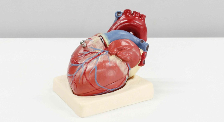 Imagem de Portugueses estudam método para identificar risco de défice cognitivo após AVC