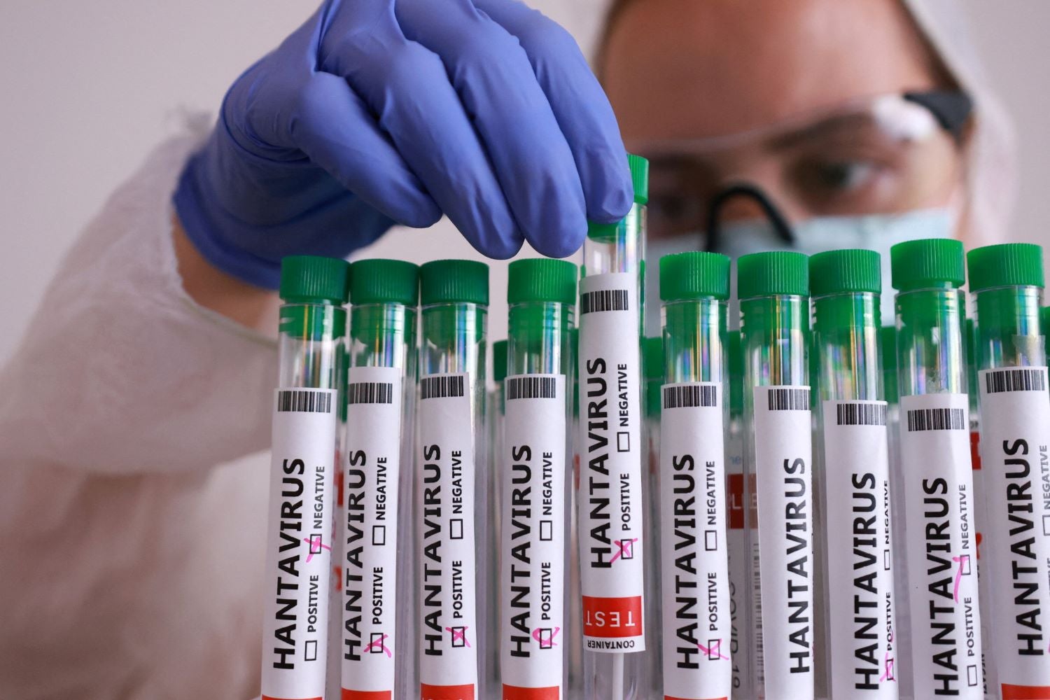 Países Baixos. Dois casos suspeitos de exposição ao hantavírus testam negativo