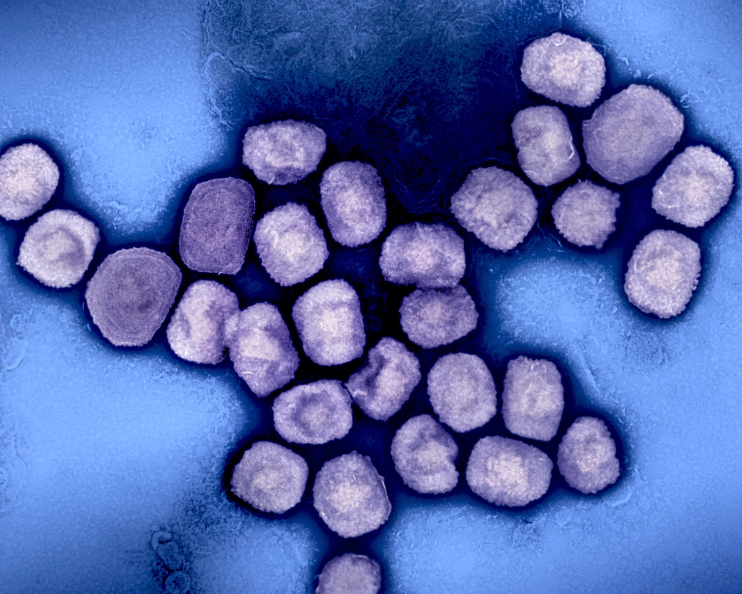 Portekiz’de mpox’un toplum içinde yayıldığı doğrulandı: Son altı haftada 66 Clade Ib vakası bildirildi
