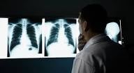 Queda de diagnósticos de cancro no auge da epidemi