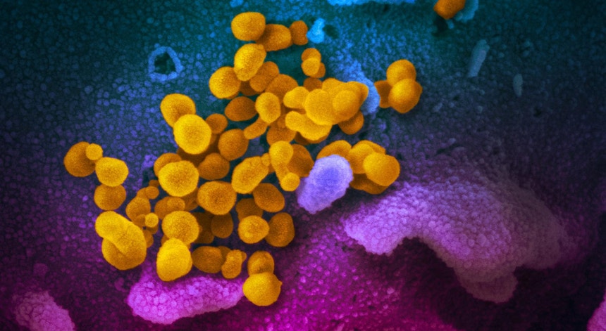Imagens recolhidas por um microscópio eletrónico num laboratório dos EUA, mostram vírus sars-CoV-2, a amarelo, a emergirem de células (azuis e cor-de-rosa) cultivadas 
