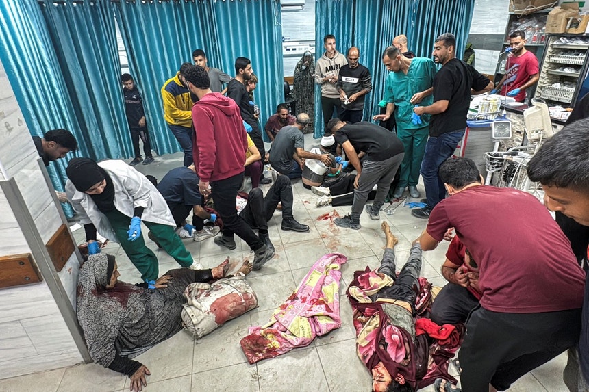 Vítimas de combates entre Israel e o Hamas em Jabalia, Gaza, no hospital de Kamal Adwan, a 21 de outubro 2024
