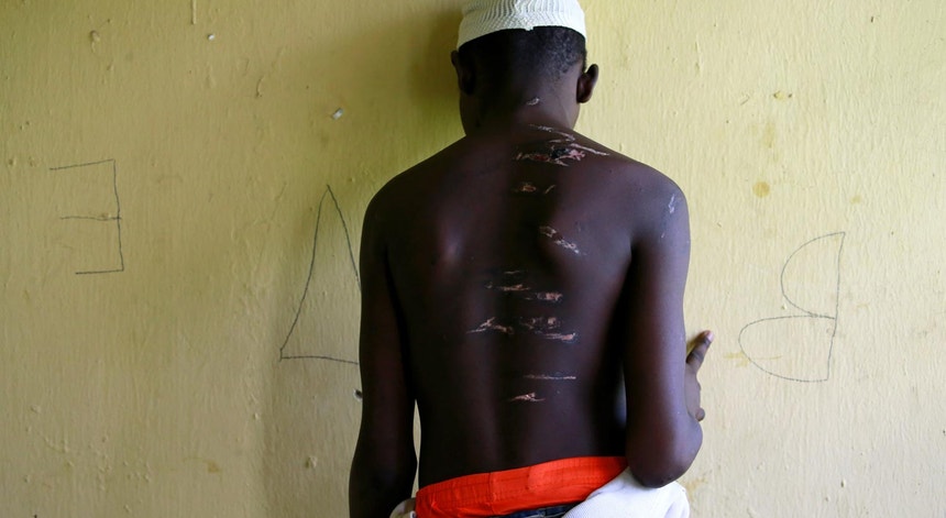 Um rapaz de 15 anos mostra as cicatrizes, após ter sido libertado no final de setembro de 2019, de uma escola islâmica, em Kaduna, juntamente com centenas de outros adolescentes.
