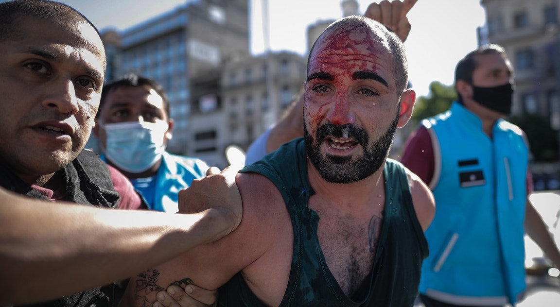  Argentina, Buenos Aires, adepto ferido nos confrontos com a pol&iacute;cia durante o funeral de Maradona, |Juan Ignacio Roncoroni - EPA 