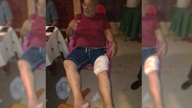 Imagem de Deputado Agnelo Regala atacado a tiro