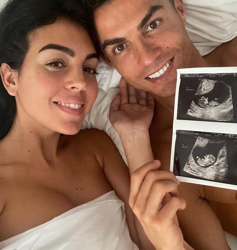 Ronaldo vai ser pai de gémeos