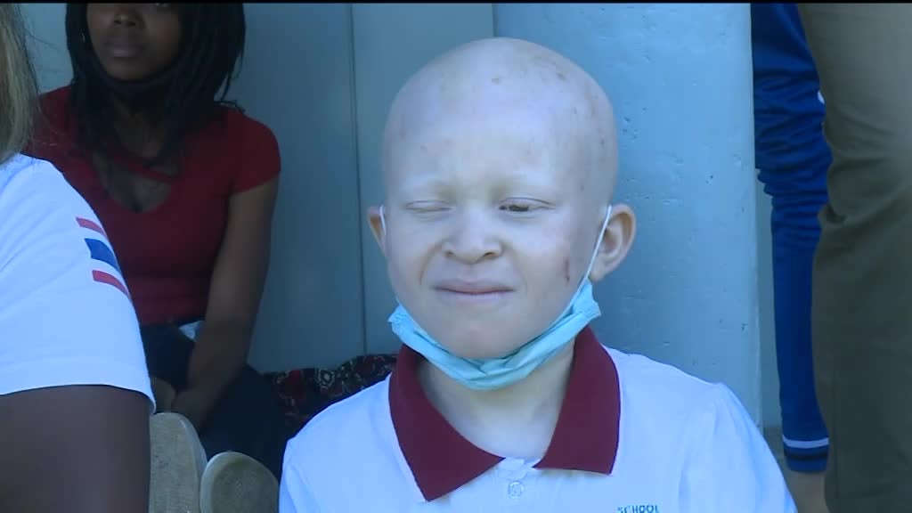 Imagem de Triunfar na Diferença