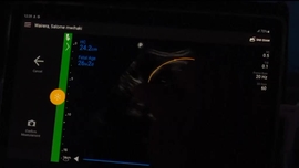 Imagem de frica Global