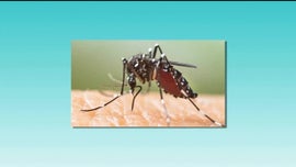 Dengue