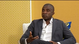 Imagem de Rinoplastia