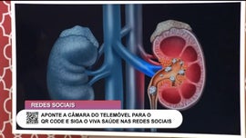 Imagem de Pedra nos Rins