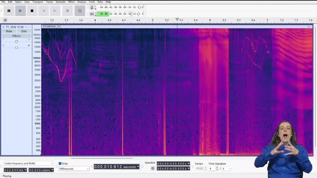 Imagem de Radar XS