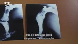 Imagem de Ondas que Curam - O Surpreendente Poder Regenerativo da Terapia por Ondas de Choque