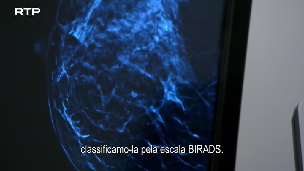 Imagem de Questões de Saúde - Diagnóstico de Cancro da Mama - Novas Terapias, Melhores Hipóteses de Cura