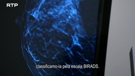 Imagem de Diagn�stico de Cancro da Mama - Novas Terapias, Melhores Hip�teses de Cura
