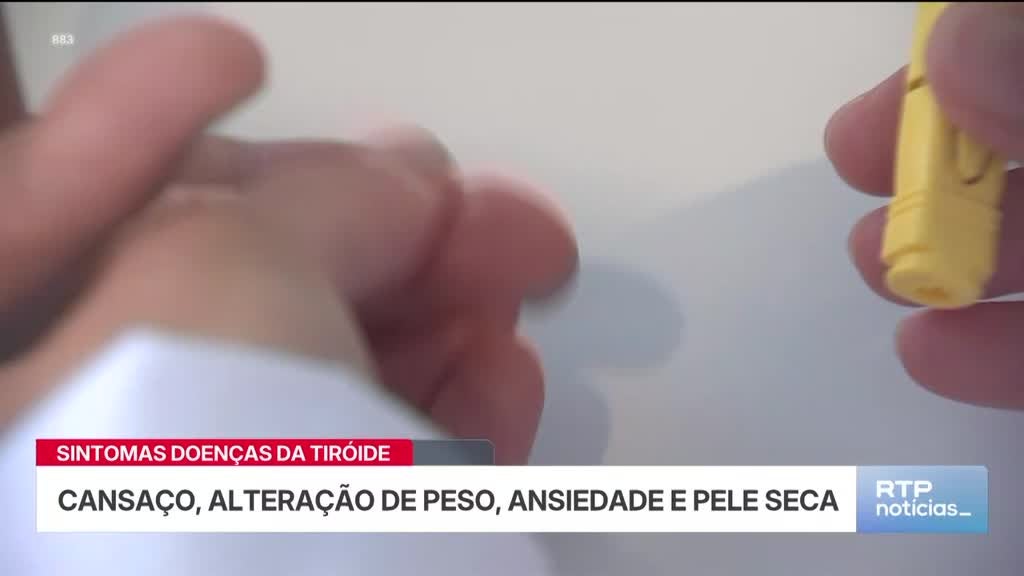 Imagem de Notícias 14